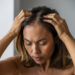 thinning hair home remedies