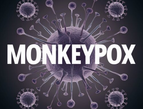 natural monkeypox remedies